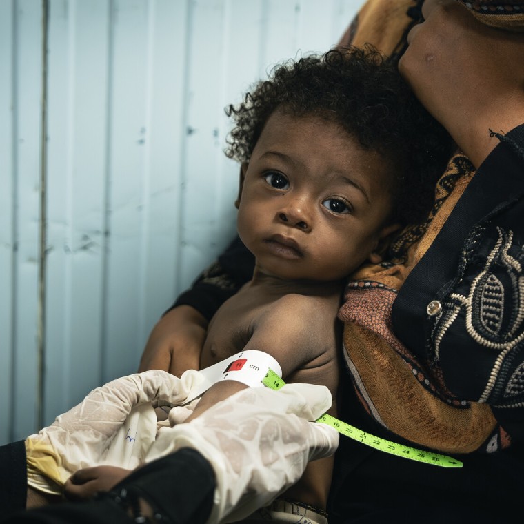 Basam* attends a Concern supported health clinic in Yemen